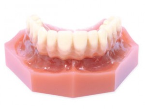 semi-removable-acrylic-bridge